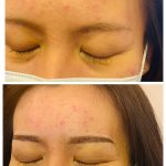 Before and After Eyebrow Embroidery for Lady - Close up 35