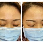 Close-up Comparison Before & After Ladies Eyebrow Embroidery 10
