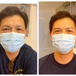 Men Eyebrow Embroidery in Singapore - Before and After 7
