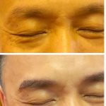 Feng Shui Eyebrow Embroidery for Men - Before and After