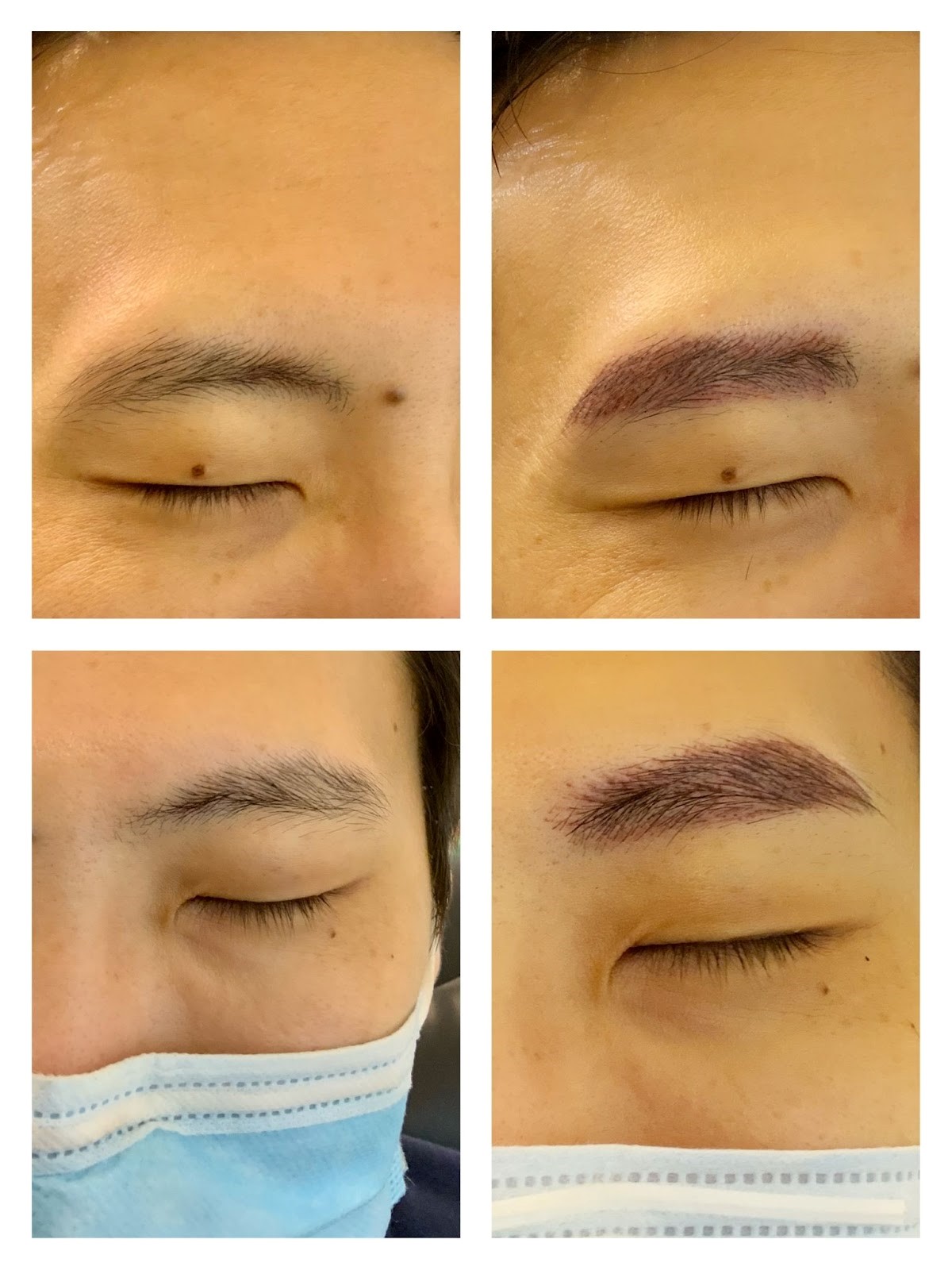 What Not To Do After Eyebrow Embroidery Eyebrow Embroidery in Singapore